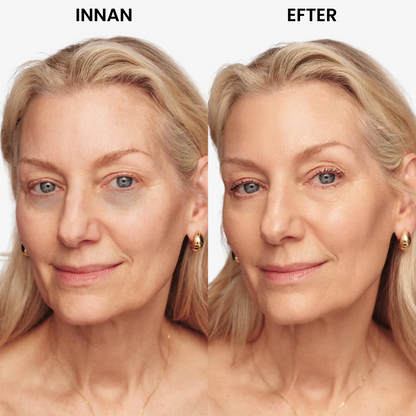 Under Eye Brightener